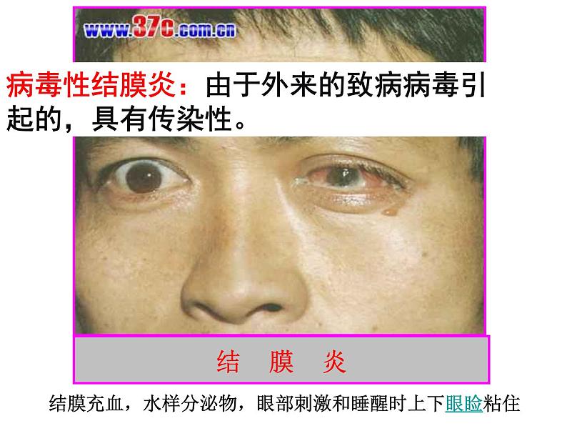 初中生物人教版八年级下册 第一节传染病及其预防 7 课件05