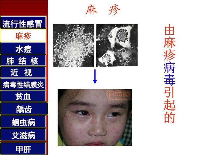 初中生物人教版八年级下册 第一节传染病及其预防 5 课件第5页