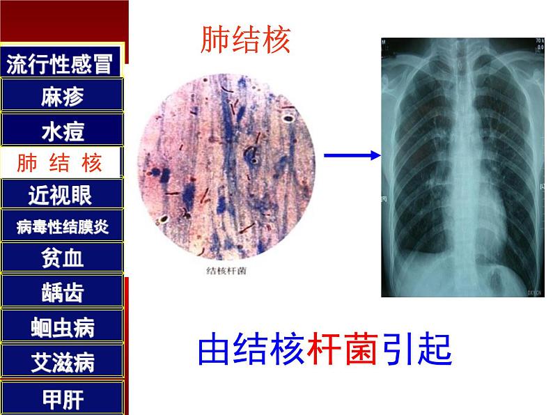 初中生物人教版八年级下册 第一节传染病及其预防 5 课件第7页