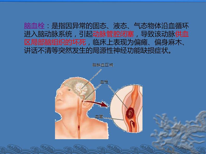 冀教版七年级下册生物 2.4心脏和血管的保护 课件05