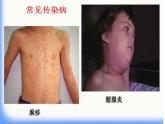北师大版七下生物 13.2预防传染病 课件