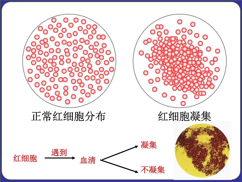 人教版七下生物  4.4输血与血型  课件07