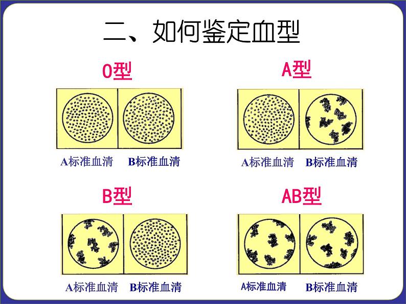 人教版七下生物  4.4输血与血型  课件08