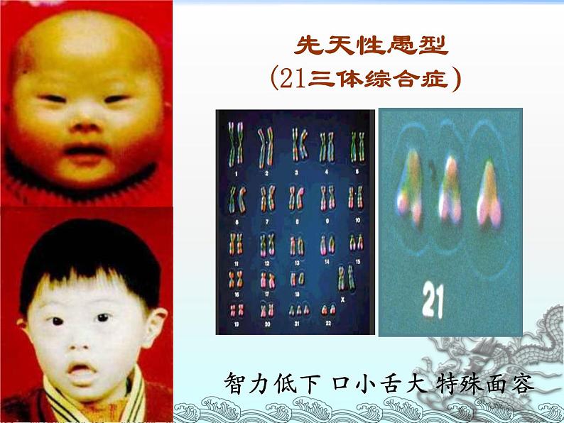 苏教版八年级下册生物 22.4遗传病和优生优育 课件06