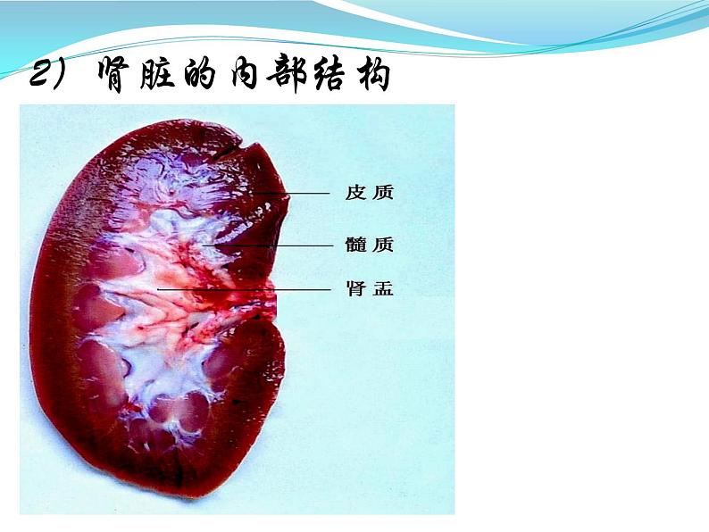 人体内废物的排出课件PPT第7页