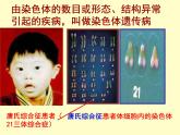 冀教版八年级下册生物  6.2.3遗传病与优生 课件