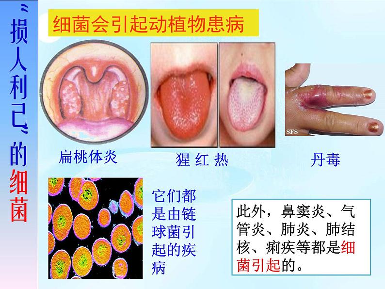 5.4.4 细菌和真菌在自然界中的作用课件PPT08