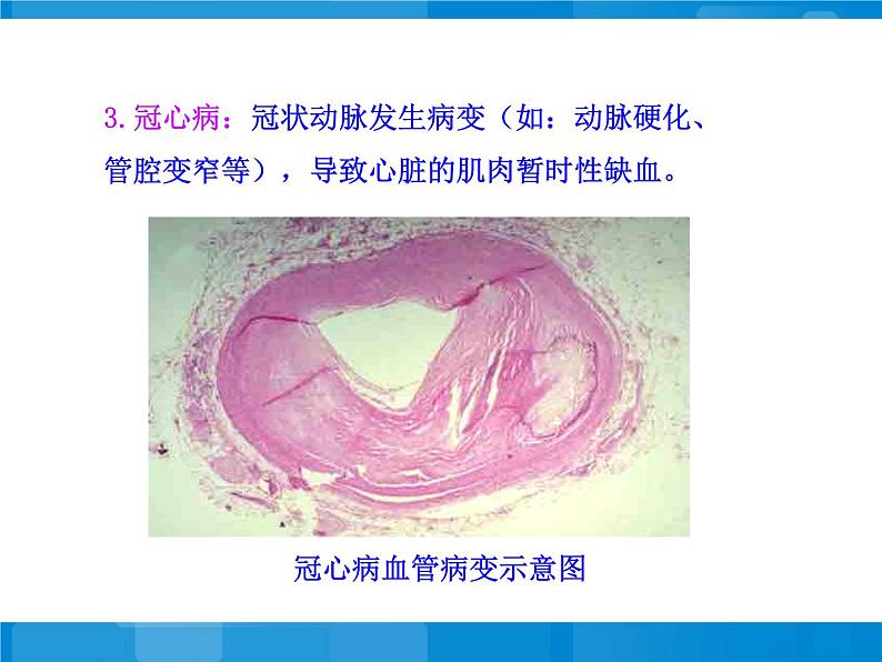 苏教版八年级下册生物 25.2威胁健康的主要疾病 课件07