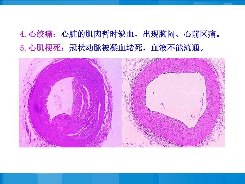 苏教版八年级下册生物 25.2威胁健康的主要疾病 课件08