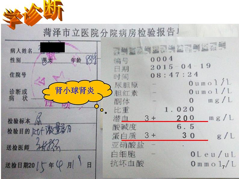 济南版七下生物 4.1尿液的形成和排出 课件07