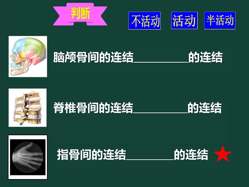 初中生物苏科版八年级上册 人体的运动骨的连结部优课件05