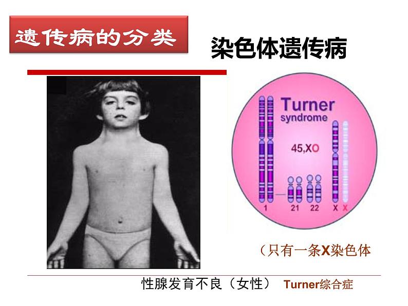 冀教版八年级下册生物  6.2.3遗传病与优生 课件08