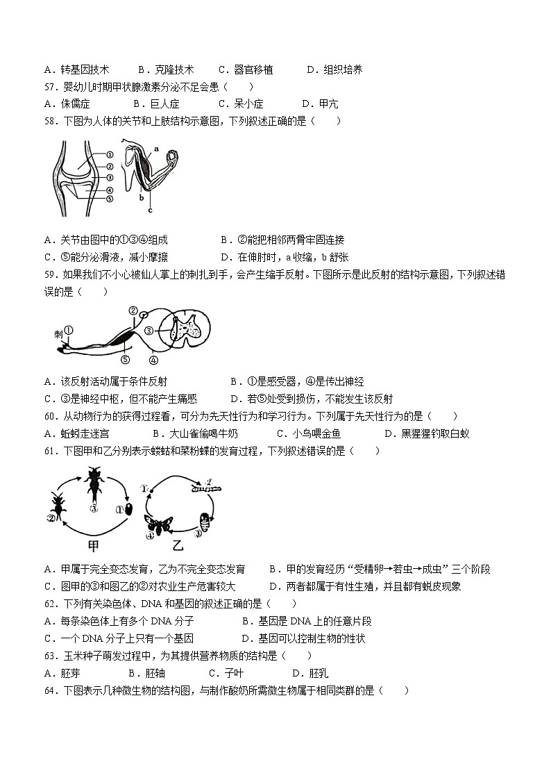 2022年江苏省泰州市海陵区中考一模生物试题03