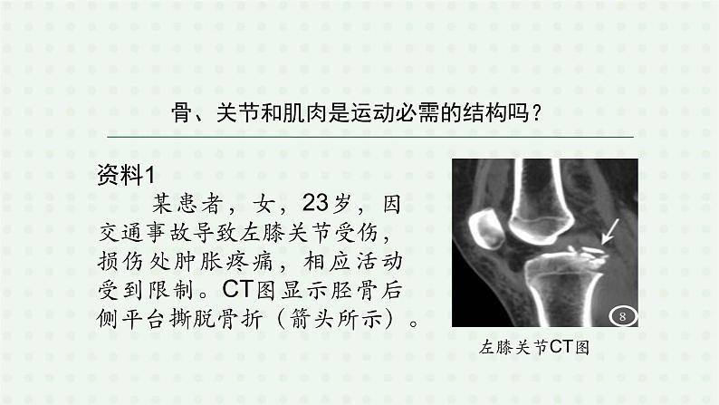 5.2.1《动物的运动》（1）-课件04