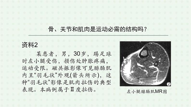 5.2.1《动物的运动》（1）-课件05