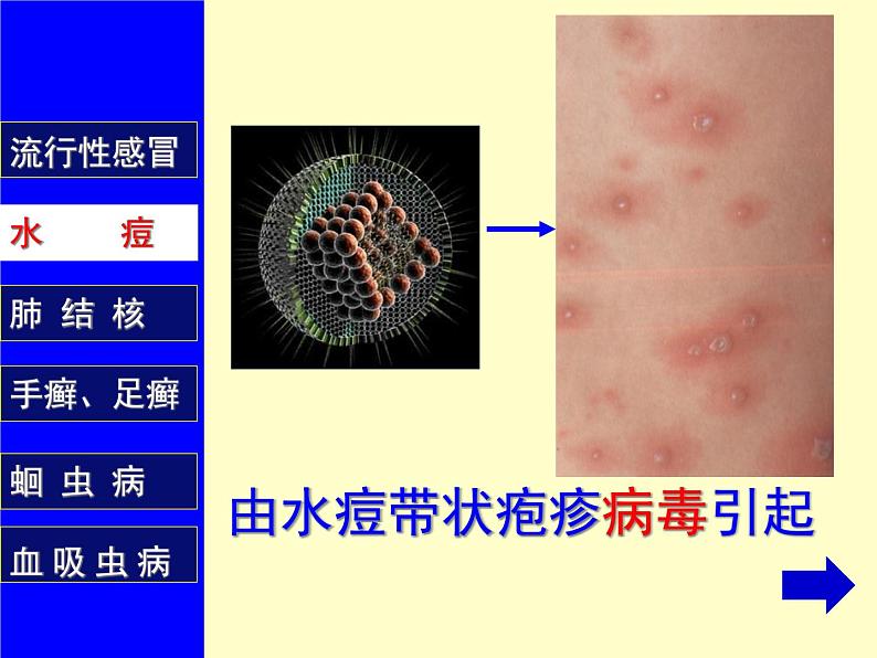 苏教版八年级下册生物 25.1传染病 课件07