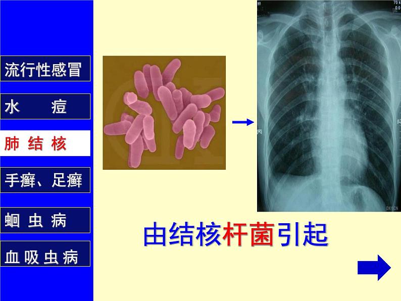 苏教版八年级下册生物 25.1传染病 课件08