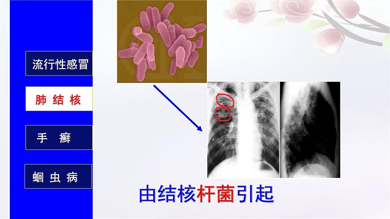 济南版七年级下册生物 6.2传染病及其预防 课件第5页