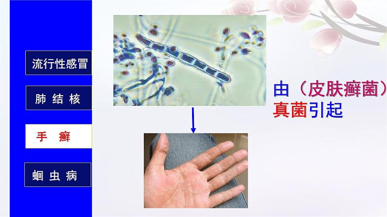 济南版七年级下册生物 6.2传染病及其预防 课件第6页