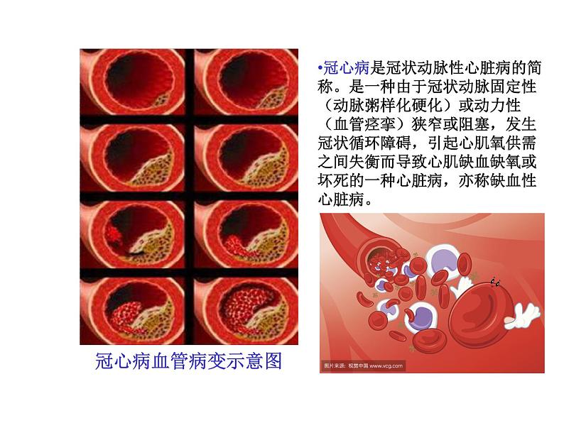 苏教版八年级下册生物 25.2威胁健康的主要疾病 课件08