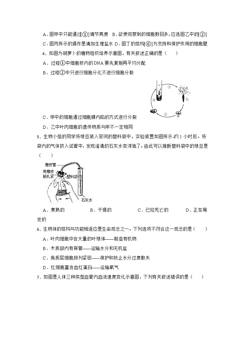 2022年湖南省娄底市涟源市中考模拟（一）生物试题02