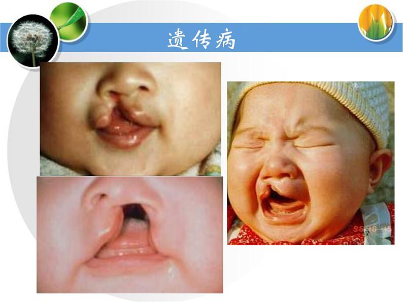 冀教版八年级下册生物  6.2.3遗传病与优生 课件第6页