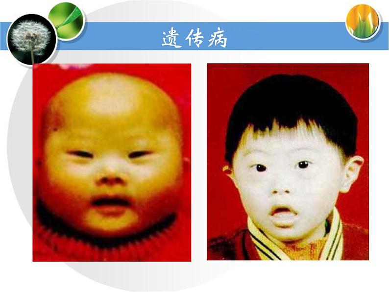 冀教版八年级下册生物  6.2.3遗传病与优生 课件第7页