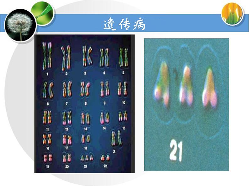 冀教版八年级下册生物  6.2.3遗传病与优生 课件第8页