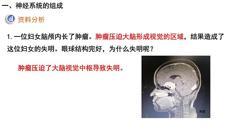 4.6.2神经系统的组成课件2021-2022学年人教版七年级下册生物第3页