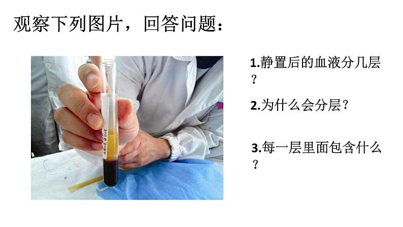 4.4.1流动的组织——血液课件2021--2022学年人教版生物七年级下册第6页