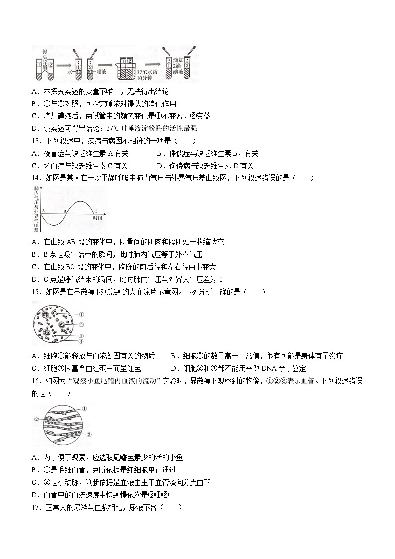 2022年山东省临沂市中考生物真题(word版无答案)03