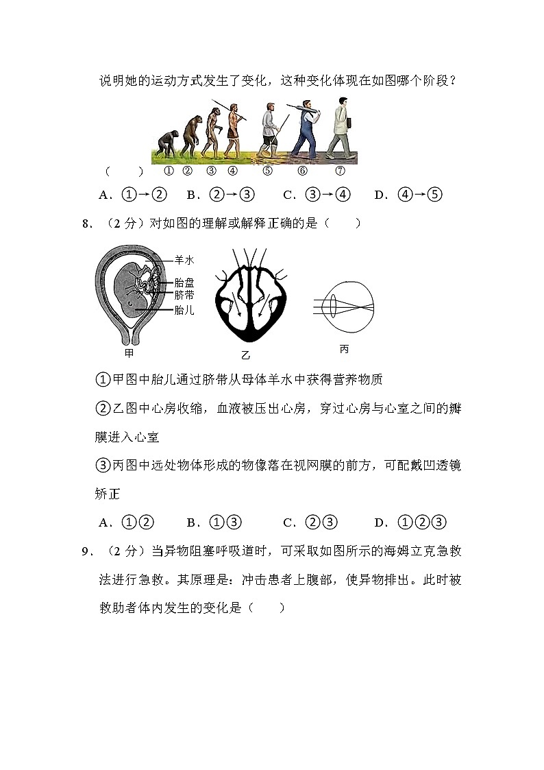 2022年湖北省宜昌市中考生物试卷解析版03
