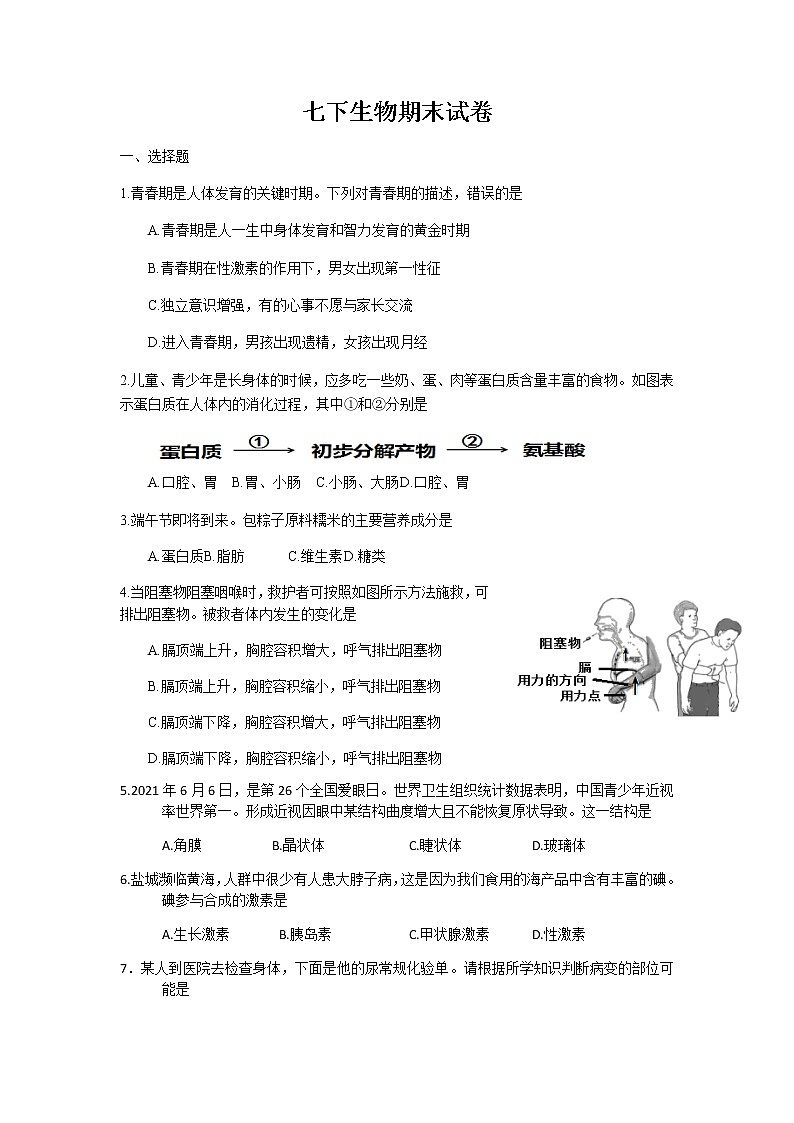 江苏省盐城市建湖县2021-2022学年七年级下学期期末生物试卷（无答案）第1页