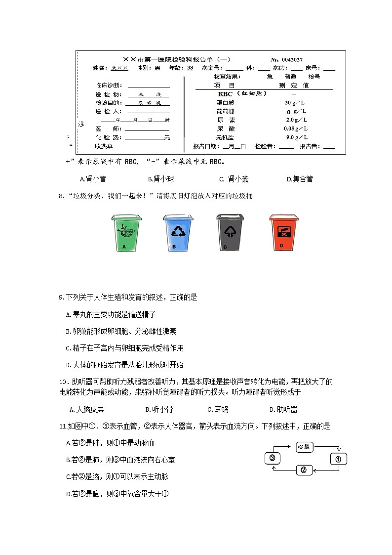 江苏省盐城市建湖县2021-2022学年七年级下学期期末生物试卷（无答案）第2页