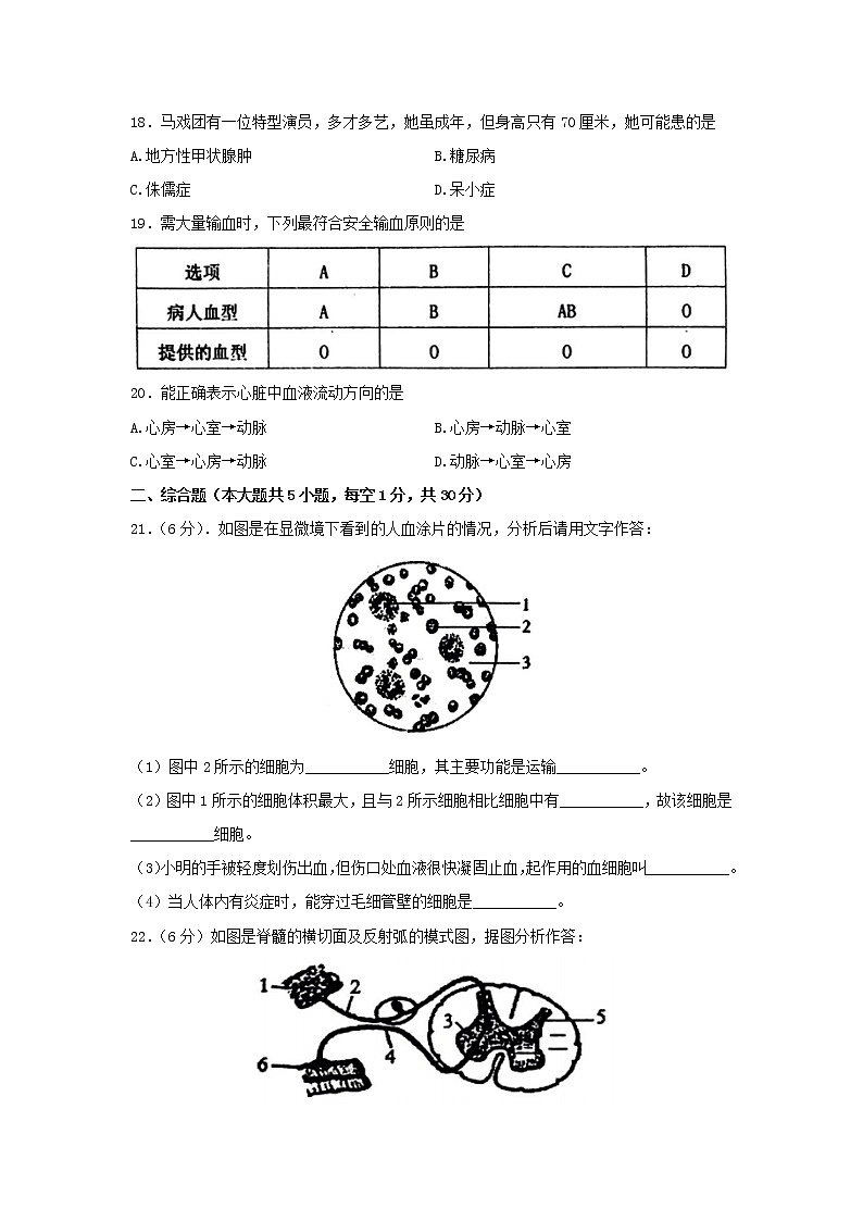江西省鹰潭市余江区2021-2022学年七年级下学期期末生物试卷(word版含答案)第3页