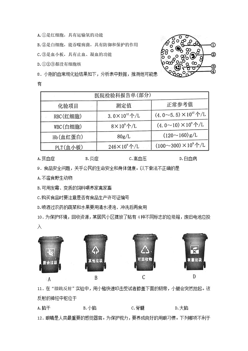 山西省晋中市2021-2022学年七年级下学期期末考生物试题(word版含答案)02