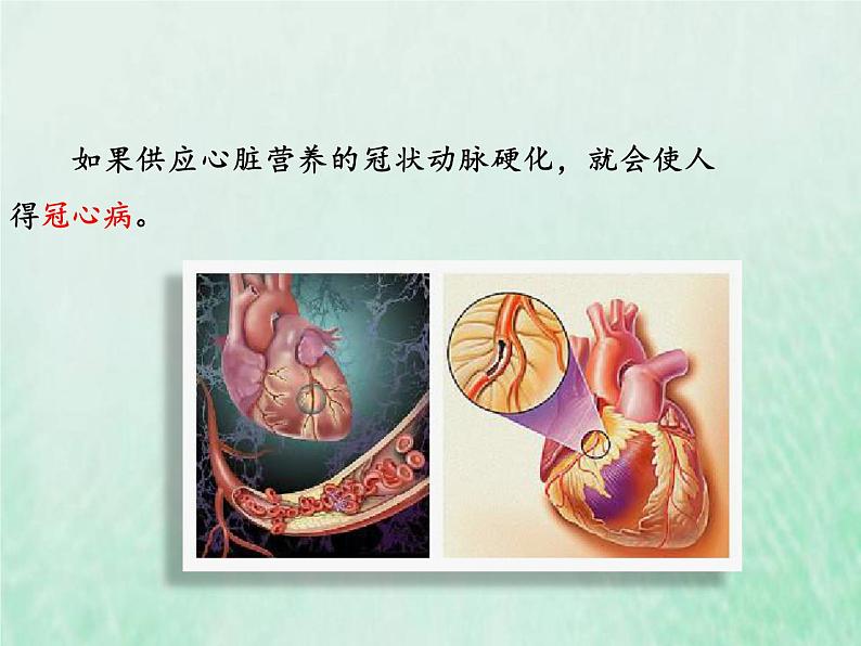 北师大版七年级生物下册第4单元生物圈中的人第13章健康地生活第4节当代主要疾病和预防课件04