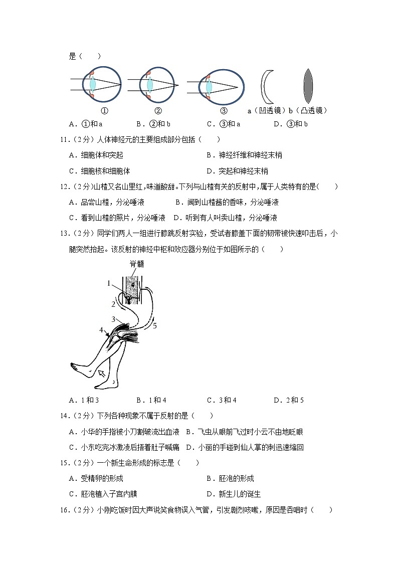 山西省太原市2021-2022学年七年级下学期期末生物试卷(word版含答案)03