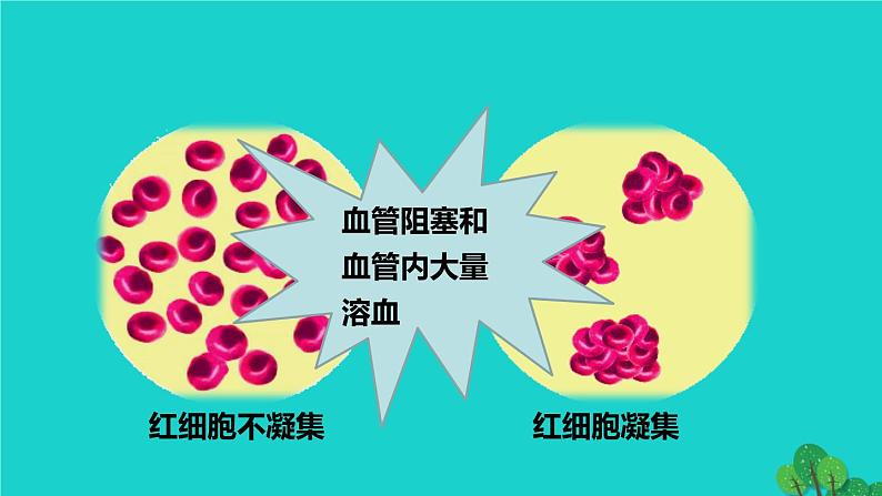 生物人教版七年级下册同步教学课件第4单元 生物圈中的人第4章 人体内物质的运输第4节输血与血型07