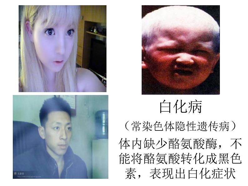 北师大版八年级上册生物  20.6 遗传病和人类健康 课件第5页
