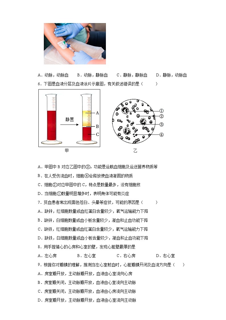 四川省成都市龙泉驿区2021-2022学年七年级下学期期末生物试题(含答案)02