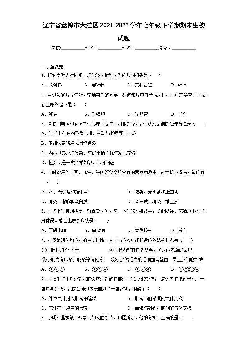 辽宁省盘锦市大洼区2021-2022学年七年级下学期期末生物试题(含答案)01