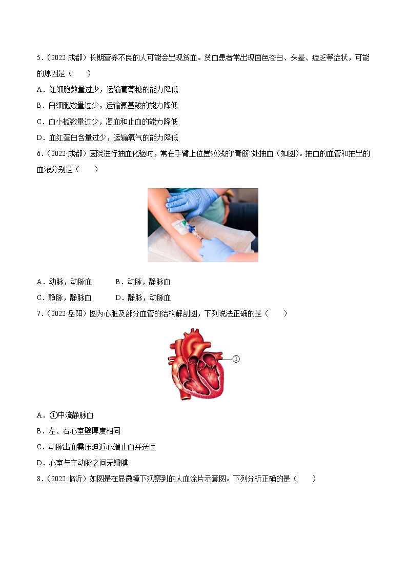 专题06 人体的物质运输和废物排出-三年（2020-2022）中考生物真题分项汇编（全国通用）（原卷版）第2页