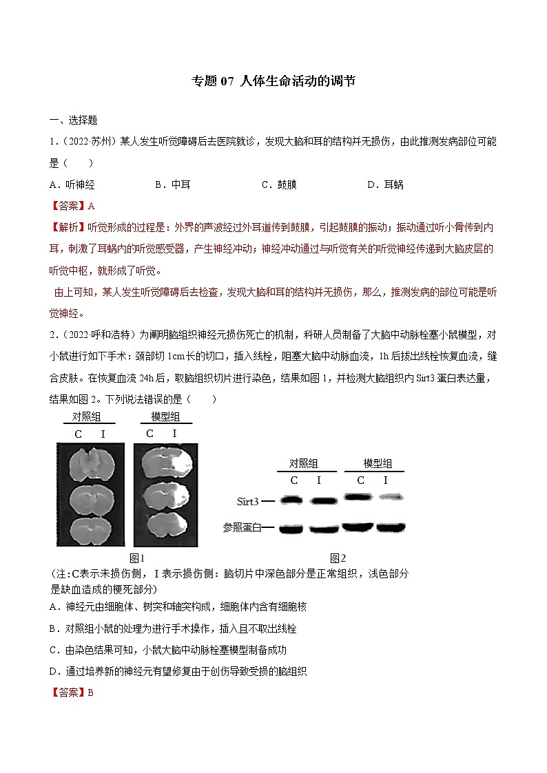 2020-2022年全国中考生物3年真题汇编 专题07 人体生命活动的调节（学生卷+教师卷）01