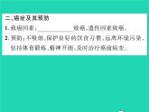 2022七年级生物下册第13章降地生活第4节当代主要疾病和预防习题课件新版北师大版