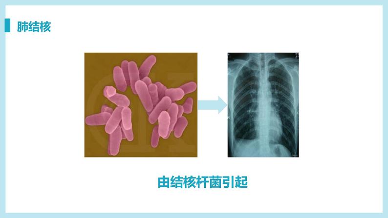 第一节 传染病及其预防 课件08