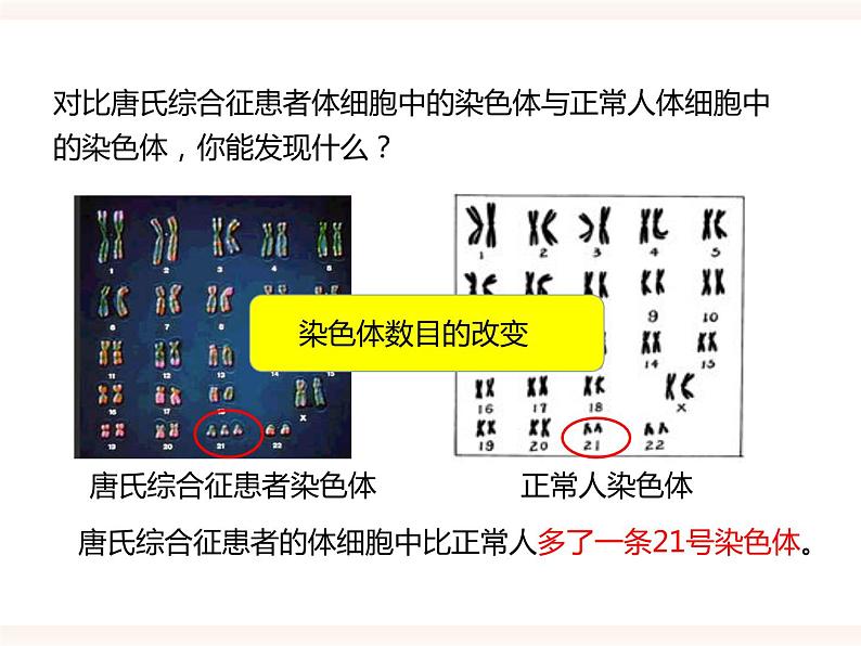 第六单元第二章第三节《遗传病与优生》（课件）第8页