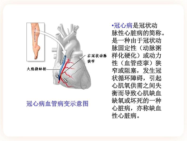 25.2威胁健康的主要疾病 课件06