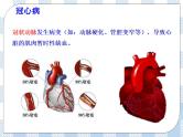 4.13.4当代主要疾病和预防 课件+同步练习+视频