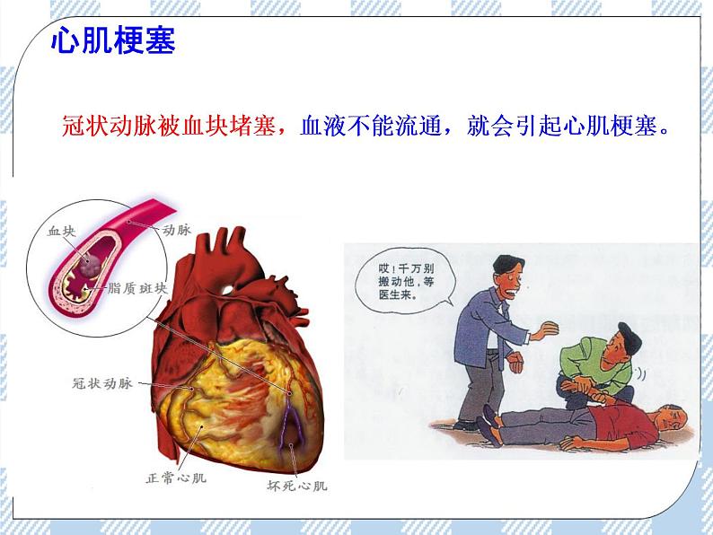 4.13.4当代主要疾病和预防 课件+同步练习+视频07